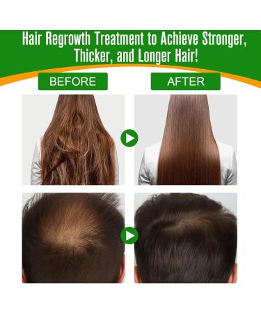 Batana Oil for Hair Growth 100% Pure & Natural Batana Oil for Healthier Thicker Fuller Hair Eliminate Hair Split Ends Repairs Damaged Hair & Skin For Men & Women 60ml - Buy Online on GoSupps.com