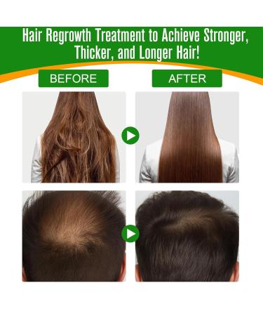 AIQIUSHA 100% Organic Batana Oil for Hair Growth | 60ML Pure Cold Pressed Essential Oil for Hair Skin & Eyelashes - Buy Online on GoSupps.com