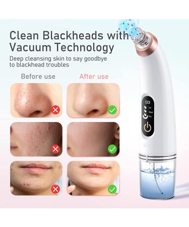 Blackhead Remover Pore Vacuum with USB Interface - Pore Cleaner for Men and Women | 3 Modes & 6PCS Suction Heads - White - Buy Online on GoSupps.com