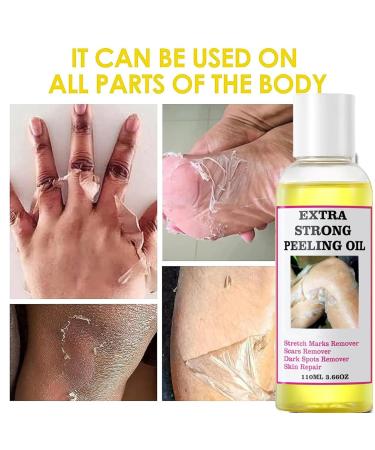 Extra Strong Peeling Oil - Yellow Exfoliating Solution for Body Hands Feet & Face - All Skin Types (110ML - Buy Online on GoSupps.com