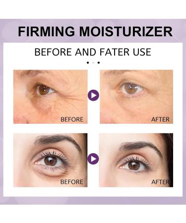 OLLZPJFPK Facial Moisturizing Cream Hydrating Nourishing Softening Improves Dry Skin Daily Care Cream - Buy Online on GoSupps.com