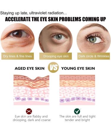  JASUBAI Set of 2 anti-aging eye creams retinol eye cream for dark circles and puffiness eye treatment serum with retinol and collagen firming eye cream - Buy Online on GoSupps.com