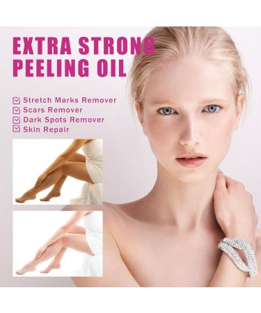 Extra Strong Peeling Oil for Dark Skin | Yellow Exfoliating Solution for Hand & Feet | Chemical Peel for Face | 110ML | Ships Internationally - Buy Online on GoSupps.com