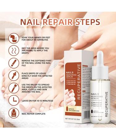 GFOUK 7 Days Nail Growth And Strengthening Serum Nail Growth and Strength Serum Nail Growth & Strengthening Oil Serum Stronger Nails in 1 Week Nail Strengthening Treatment (2 Pcs) - Buy Online on GoSupps.com