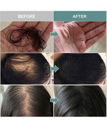 Multi-Peptide Serum for Hair growth Hair Growth Essential Oil Multi-Peptide Essential for Hair - Buy Online on GoSupps.com