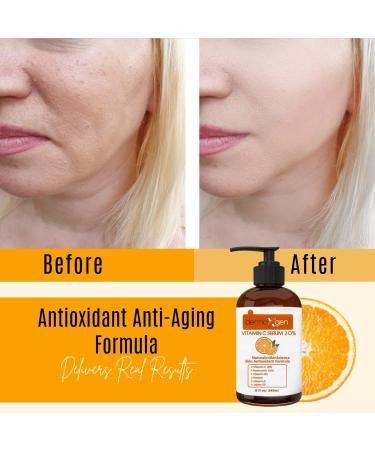 20% Vitamin C Serum with Hyaluronic Acid & Retinol - Organic Anti-Aging Moisturizer for Youthful Skin (2 FL OZ - Buy Online on GoSupps.com
