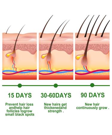 100% Pure Rosemary Oil for Hair Growth & Skin Care | Stimulate Hair Growth & Nourish Scalp | Essential Oil for Eyebrows & Eyelashes (1PC) - Buy Online on GoSupps.com