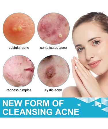 Miracle Patch | New Formula More Efficient | Pimple & Acne Patches | Invisible Miracle Spot Cover | Hydrocolloid Acne Dressing Cover Anti Acne Dots Cruelty Free Vegan | Stickers (Invisible 36 Patches) - Buy Online on GoSupps.com