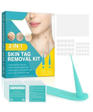Standard Skin Tag Tool Kit Quick and Painless Solution for Medium to Small Skin Tags/Complete Skin Tag Tool Kit for Fast Results (2mm-5mm)