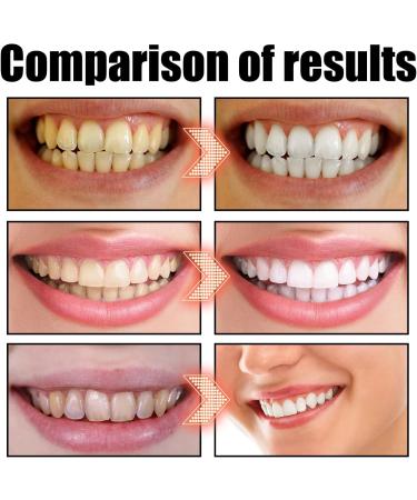 Lightening Oil Mouthwash - Coconut & Peppermint Oil Pulling for Fresh Breath Teeth Whitening & Healthier Gums - 1 Piece - Buy Online on GoSupps.com