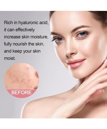 5 In 1 Cleansing Face Wash Foaming Cream Cleanser Water Based Cleanser Natural Foaming Cleaner Skin Care with Niacinamide Hyaluronic Acid Removes Excess Oil Unclogs Pores Reduces Blackheads - Buy Online on GoSupps.com