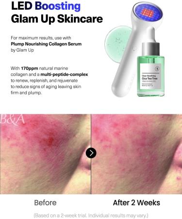 Anti-Breakout Blue Beauty Beam by CELLECT - Portable Red Infrared Blue LED Facial Device for Blemish Clearing | Spa & Home Skincare - Buy Online on GoSupps.com