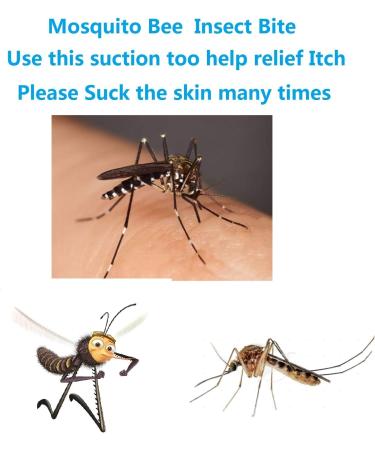 Finever 2PK Mosquito Bee Sting Bug Bite Kit | Safety First Aid Supplies for Hiking Backpacking Camping | Natural Suction Tool - Buy Online on GoSupps.com