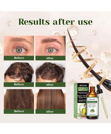 Aeshory Hair Oil - 5 IN 1 Hair Care with Rosemary Castor Argan Vitamin E & Avocado - Nourishing & Volumizing Hair Growth Oil (3.38 fl oz - Buy Online on GoSupps.com
