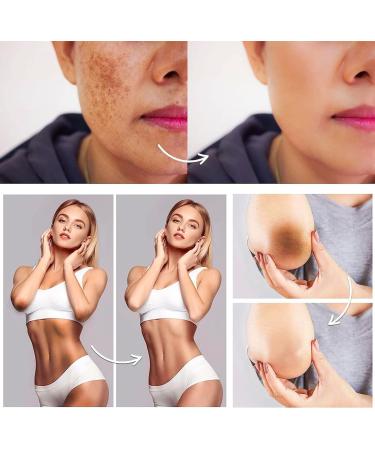Intimate Lightening Cream Whitening Cream For Intimate Parts Radiance Cream Intimate Lightening Cream Underarm Whitening Cream Bleaching Cream For Intimate Areas (2pc) - Buy Online on GoSupps.com