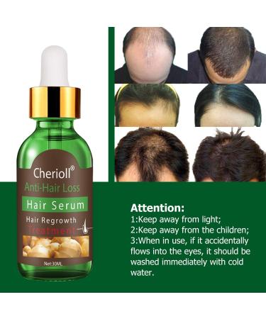 Hair Growth Serum for Thicker Fuller Hair | Treat Hair Loss & Stimulate New Growth - Buy Online on GoSupps.com