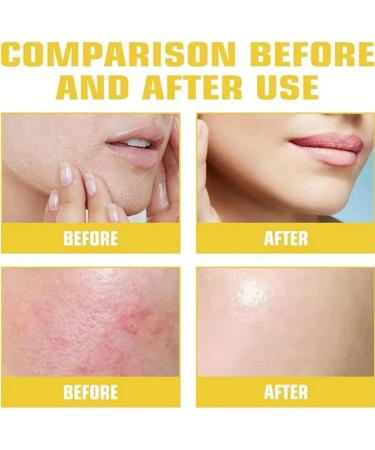 Skincare Serum for Face Skin Scar Soothing Serum Serum Korean Korean Toner Korean Skincare Serum Korean Serum for Face Korean Serum Korean Glass Skin Care Korean Face Serum Gentle for Women and Men - Buy Online on GoSupps.com