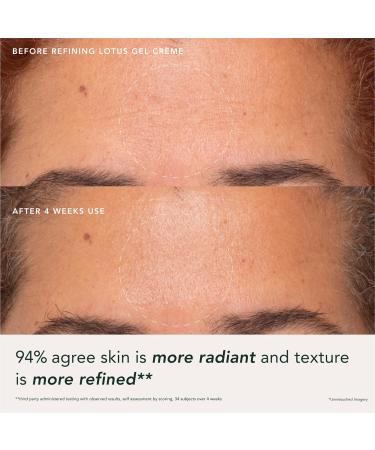 Buy RANAVAT Refining Lotus Gel Cream - Hydrating Gel Moisturizer & Pore Minimizer with Hyaluronic Acid - Improve Radiance & Texture - International Shipping Available - Buy Online on GoSupps.com