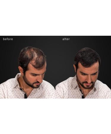 LUXE Hair Thickening Fibers - 2 Months+ Supply in Gray | Hypoallergenic & Dermatologist Tested for Confidence Boost - Buy Online on GoSupps.com