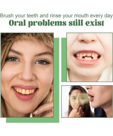 KLYso Portable Press-Type Teeth Whitening Foam Toothpaste - Remove Tartar & Stains Cleanse & Protect Gums Brighten & Whiten Teeth(1PCS) - Buy Online on GoSupps.com