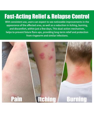 Drawing Salve Cream for Boil Cyst & Splinter Removal | Fast-Acting 2 oz. | Relief from Ingrown Hair, Bug Bites, Sting & Itch - Maximum Strength - Buy Online on GoSupps.com