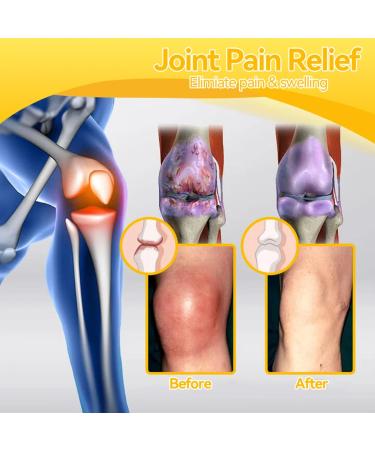 Spzv Bee Venom Joint & Bone Therapy Cream - Muscle & Arthritis Pain Relief (1 Fl Oz) | New Zealand Bee Venom Gel for All Body Parts - Men & Women - Buy Online on GoSupps.com