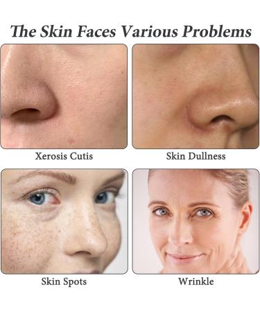 Hyaluronic Acid 2% + B5 30ML Hyaluronic Acid Serum for Face Dark Spot Remover for Face Hyaluronic Acid Face Moisturize Skincare Serum for Face to Plump and Smooth Skin for All Skin Types Skin Care - Buy Online on GoSupps.com