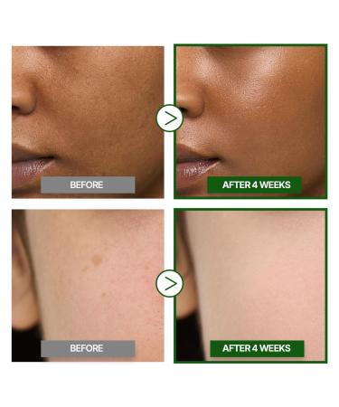 GOODAL Green Tangerine Vitamin C Cream Advanced Ver. Vitamin C Cream with 5% Niacinamide | Fades Dark Spots Boosts Radiance & Hydrates | Korean Skincare 1.69oz / 50ml Vita C Serum (Advanced Ver.) - Buy Online on GoSupps.com
