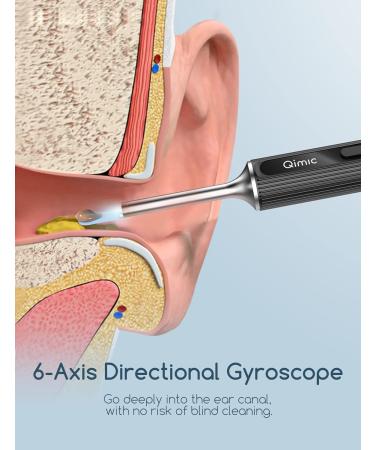 Qimic 1080P FHD Wireless Ear Wax Remover Camera | Ear Cleaner Kit with 6 LED Lights | Visual Otoscope for Adults, Kids & Pets - Black - Buy Online on GoSupps.com