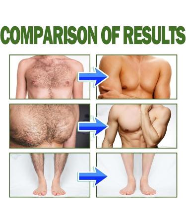 Body Hair Removal Cream for Men - 60ml Natural Hair Removal Cream | Natural Hair Remover for Men - For Face Underarms Arms Legs Thighs and Inner Areas - Buy Online on GoSupps.com