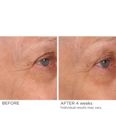 NassifMD Eye Renewal Cream | Anti-Aging Firming Eye Cream for Dark Circles & Puffiness | Best Eye Cream for Women - Buy Online on GoSupps.com