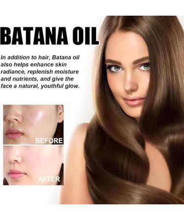 Batana Oil for Hair Growth - Batana Oil - 100% Natural - Promotes Hair Wellness for Men & Women Enhances Hair & Skin Radiance Leaves Your Hair Smoother Oil - for All Hair Types - Buy Online on GoSupps.com