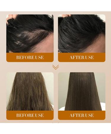  Wootapson 2 x Ginger Essential Oil Ginger Scalp Serum Hair Strength Oil Prevents Hair Loss Makes Smoothest Black and Shiny Improves Dryness of Hair - Buy Online on GoSupps.com