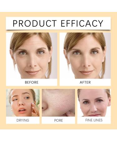 YOENBG Natural Turmeric Soap with Kojic Acid and Lemon Deep Cleansing Whitening and Moisturizing Face and Body Soap for Dark Spots Tightening Pores 3 - Buy Online on GoSupps.com