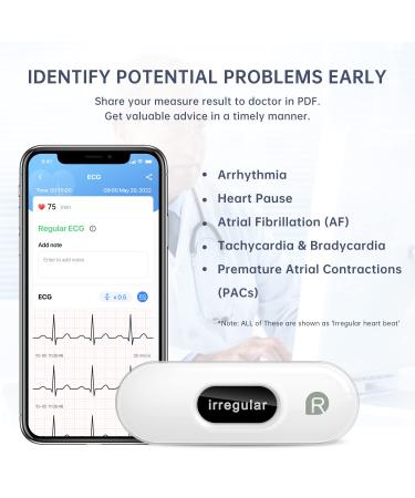 Wellue DuoEK-S Personal ECG Monitor - Bluetooth Wireless Portable Heart Monitor with OLED Screen - iOS & Android App - 30s to 5 Min Monitoring - Buy Online on GoSupps.com