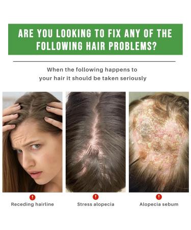 2stk Rosemary Oil for Hair Growth - Natural Hair Growth Oil for Men & Women Nourishes Scalp & Reduces Hair Loss - 60ml - Buy Online on GoSupps.com