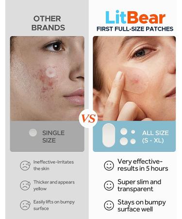 LitBear Acne Pimple Spot Patches - 80 Count Hydrocolloid Treatment for Face, Chin, Body with Tea Tree & Calendula Oil - Large Zit Breakouts Relief - Buy Online on GoSupps.com