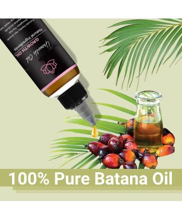 Huile de croissance des cheveux Lifewitqueenp Queenp Ayurvedic Hair Growth Huile l ger pour tous les types de cheveux 1Pcs - Buy Online on GoSupps.com