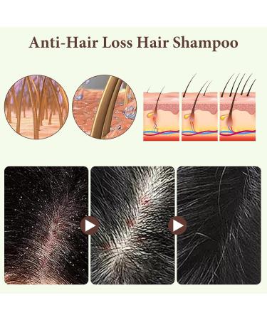 Ginger Anti-hair loss shampoo Anti-hair loss shampoo 3 boxes Hair regrowth shampoo Used to improve dry and frizzy hair (1 massage comb) - Buy Online on GoSupps.com