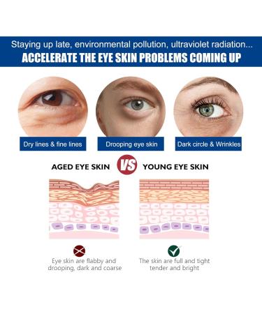 Jasmine Ointment Plus - Eye Cream for Dark Circles Corns & Loops | Collagen & Aloe Vera | 100ml - 3 Pack - Buy Online on GoSupps.com