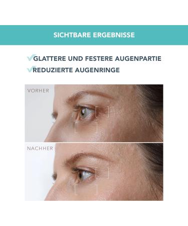 Iris Flying Eye Serum - Retinol & Bakuchiol for Dark Circles & Puffiness - Mushroom Extract & Vitamin E - Fragrance-Free - 15ml All Skin Types - Buy Online on GoSupps.com