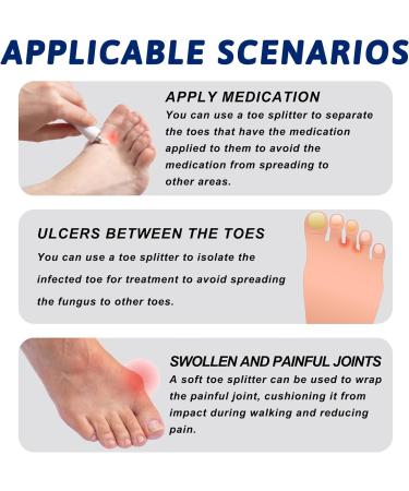 10pcs Gel Toe Separators for Overlapping Toes - Toe Corrector & Bunion Spreaders for Women and Men (Blue) - Buy Online on GoSupps.com