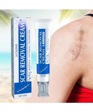  smashing Stretch Mark Cream | 30g Soothing Scar Cream for Hyperplasia | Effective Scar Smoothing for Old and New Scars | Stretch Mark Removal Cream for Men | Smashing - Buy Online on GoSupps.com