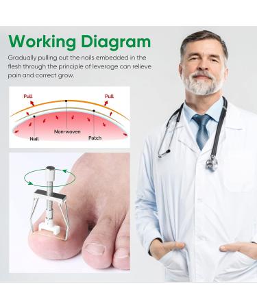 Professional Ingrown Toenail Treatment Kit | 50 PCS Corrector Patches, 4 PCS Toe Protectors - Buy Online on GoSupps.com