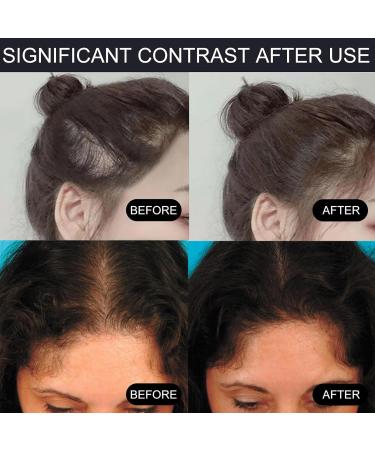 Instantly Hairline Powder Hair Root Dye Fill Forehead Root Concealer Instantly Conceals Hair Windproof Sweat-Proof Hair Touch-Up for Natural Looking 27.5g Dark Brown - Buy Online on GoSupps.com