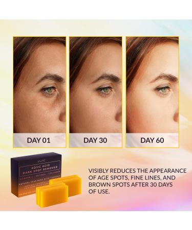 VALITIC Kojic Acid Dark Spot Remover Soap Bars - Vitamin C Retinol Collagen & Turmeric - Japanese Complex with Hyaluronic Acid & Shea Butter (4 Pack) - Shop Internationally - Buy Online on GoSupps.com
