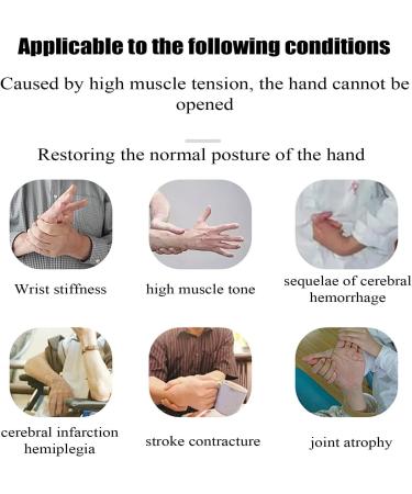 Adjustable Wrist Rehabilitation Equipment for Stroke Recovery - Right Hand Support for Tendon Injuries & Contractures - Buy Online on GoSupps.com