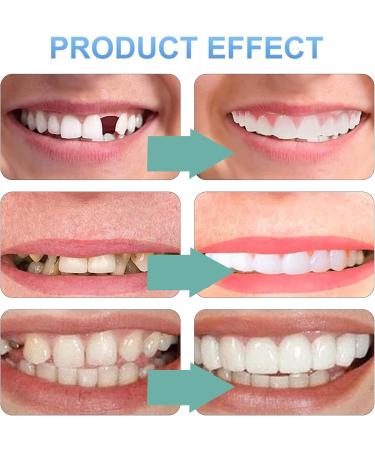 Instant Smile Makeover: Presses Fake Teeth Temporary Dentures & Cosmetic Veneers - Shop Internationally! - Buy Online on GoSupps.com