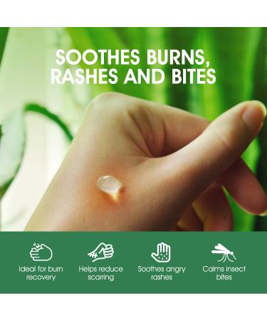 Buy Aloe Vera Gel - Cold Pressed Sunburn Relief & Moisturizer for Face Hair & Body - 10 Fl Oz - Soothes Bug Bites & Small Cuts | International Shipping - Buy Online on GoSupps.com