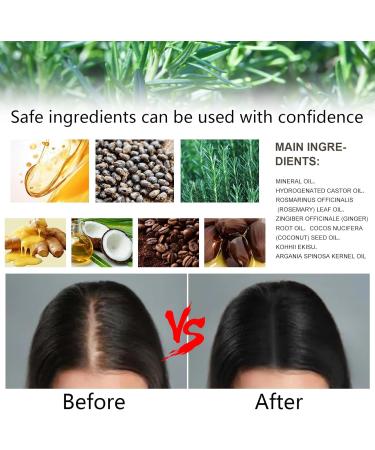  YHNMMNO Rosemary Oil for Hair & Scalp - Natural Hair Growth Oil with Organic Rosemary Oil Castor Oil Almond Oil & Argan Oil - 60ml - Buy Online on GoSupps.com